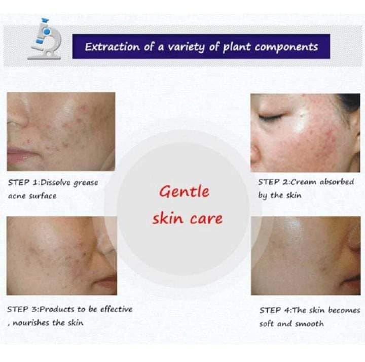 BioAqua Anti Acne set