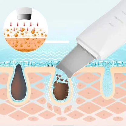 Blackhead Shovel Machine