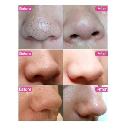 APK NOSE STRIPS PACK OF 10