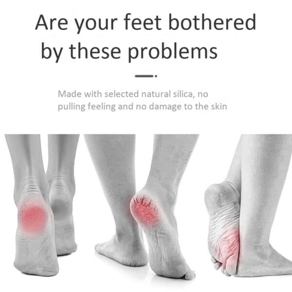 Callus Remover With Built-in Vacuum