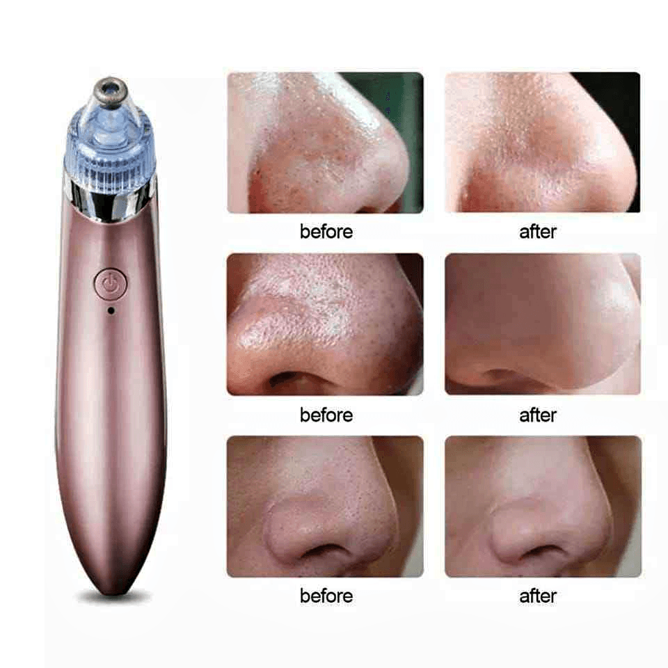 Face Pore Cleaner Blackhead Remover Vacuum Facial Cleaning Beauty Machine