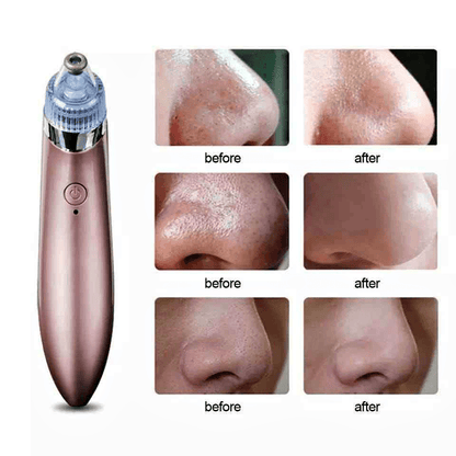 Face Pore Cleaner Blackhead Remover Vacuum Facial Cleaning Beauty Machine