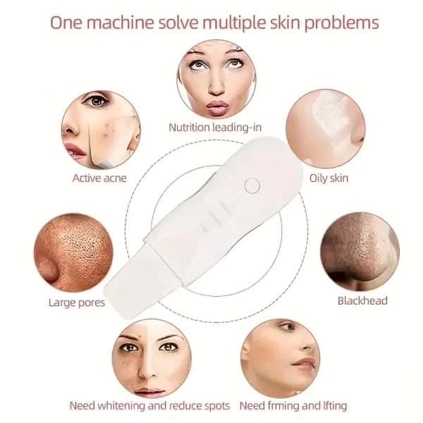 Blackhead Shovel Machine - Image 4